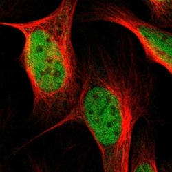 NEK11 Antibody, Novus Biologicals 0.1mL; Unlabeled:Antibodies, Polyclonal
